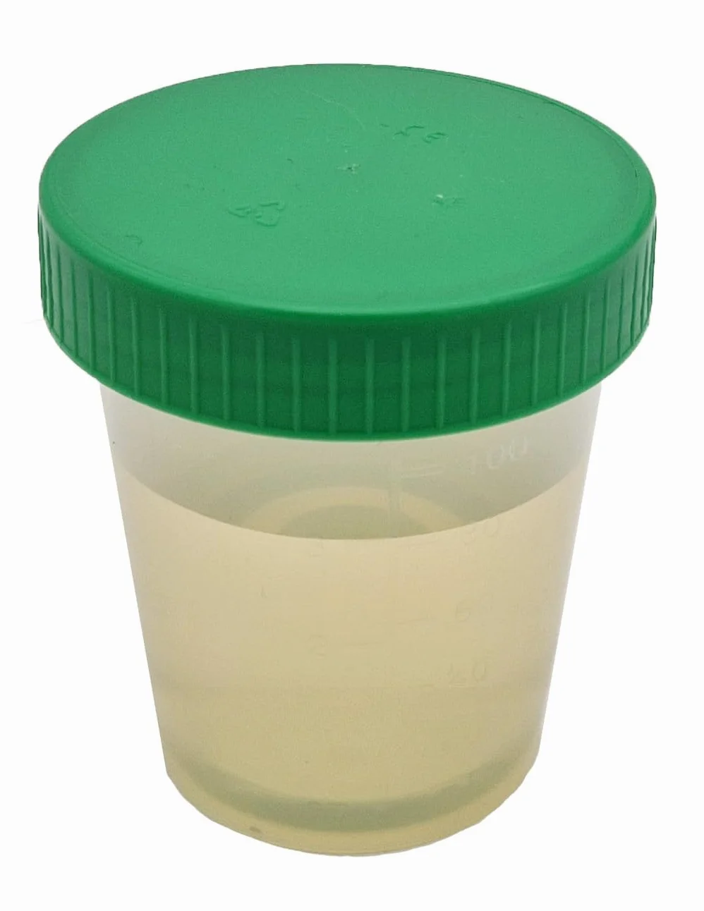 Tiga-Med Bicchieri per urina/campione, 500 pezzi, 125 ml, con tappo a vite verde, graduati fino a 100 ml, scrivibili